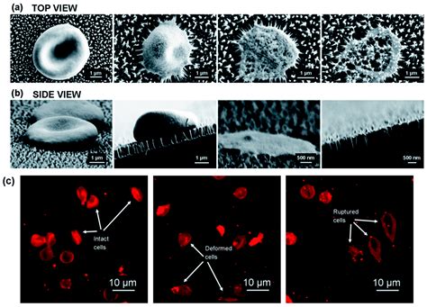 A Review on Macroscale and Microscale Cell Lysis Methods