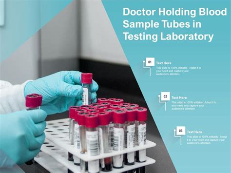 Image result for D Sample Testing in Doctor Lab