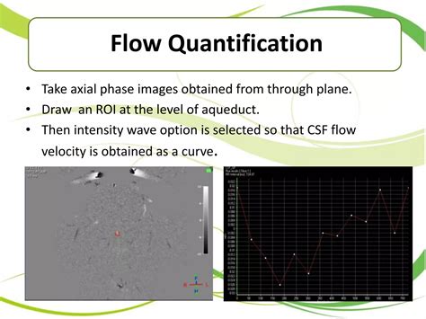 Image result for CSF Flow Test