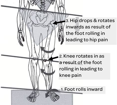 Hip Leg Foot Pain Causes at John Heidt blog