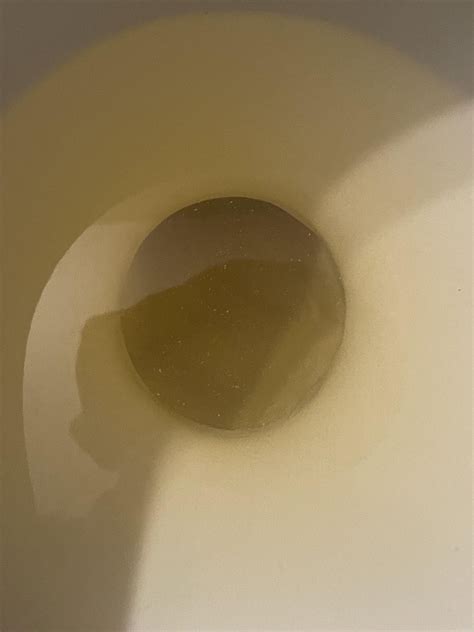 White flakes in urine : r/AskDocs