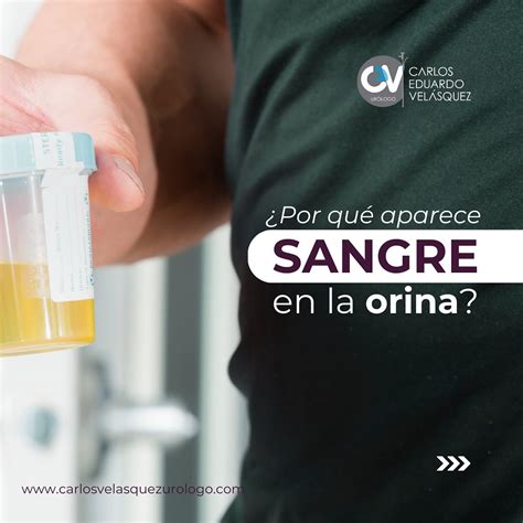 Sangre en la orina: ¿Es grave?