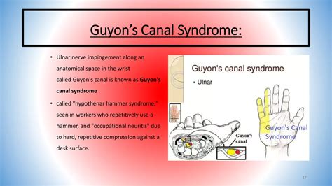 Ulnar nerve stimulation | PPTX