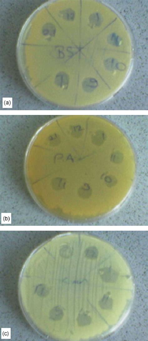 Image result for Agar Plug Diffusion Method