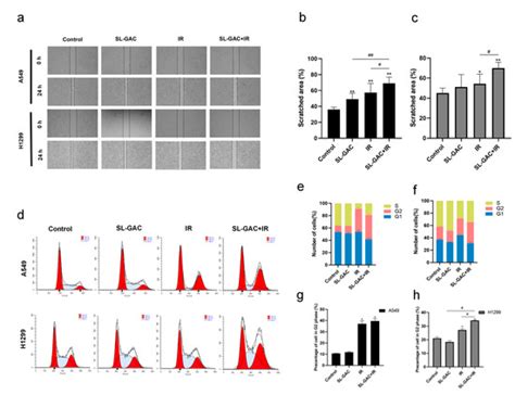 Soybean Lecithin–Gallic Acid Complex Sensitizes Lung Cancer Cells to ...