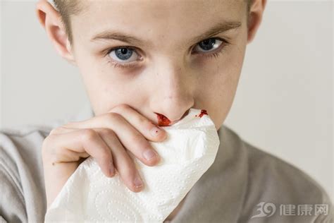 鼻子流血怎么回事怎么止血（鼻出血是怎么回事？可能与这3个因素有关，不可小看） | 说明书网