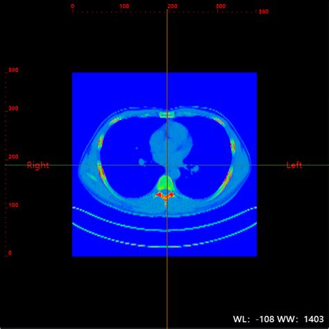 Load File DICOM Viewer 的图像结果