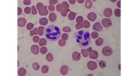 How White Blood Cells Chase And Destroy Harmful Bacteria In Our Body