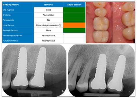 Dentistry Journal | September 2022 - Browse Articles