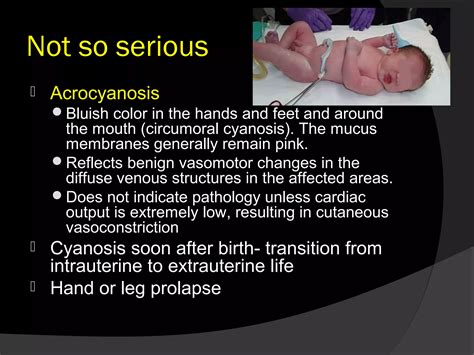 Acrocyanosis In Neonates