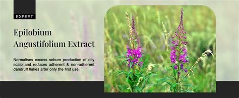 Buy Bare Anatomy Anti Dandruff Shampoo | Reduces Up to 100% Dandruff ...