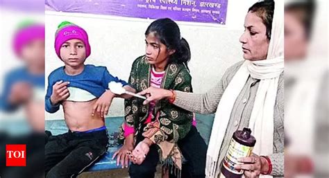 Mysterious Animal Causes Panic in Chatra: 12 Injured in Attacks ...