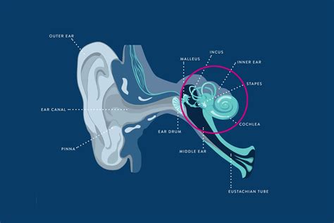 Sensorineural Hearing Loss | Signs, Causes & Treatment | THCP