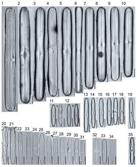 Water | Special Issue : Freshwater and/or Brackish Diatoms: Ecology and ...