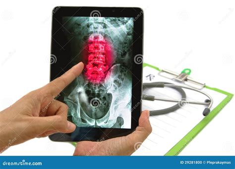 X-ray C-spine Or X-ray Image Of Cervical Spine Lateral Extension And Flexion View Stock Photo ...