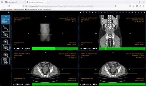 Software Service - Radiology Pacs Software Trader - Retailer from Zirakpur