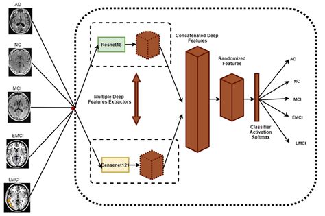 An Intelligent System for Early Recognition of Alzheimer’s Disease ...