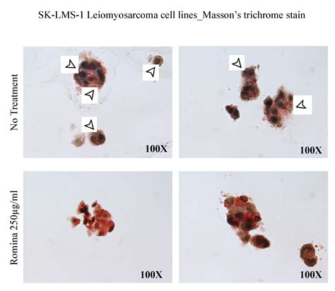 The In Vitro Effects of Romina Strawberry Extract on 3D Uterine ...