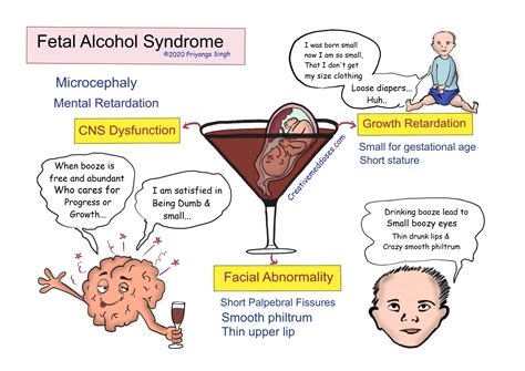 Fetal Alcohol Syndrome