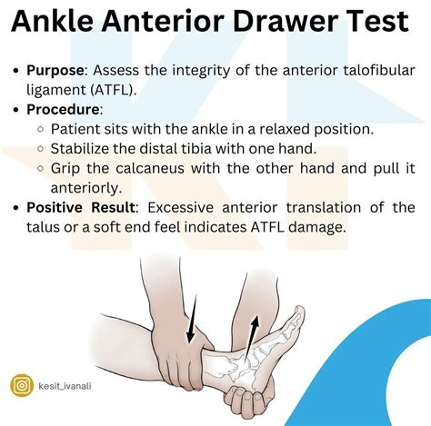 Ankle Anterior Draw Test - MEDizzy