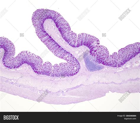 Crypts Of Lieberkuhn