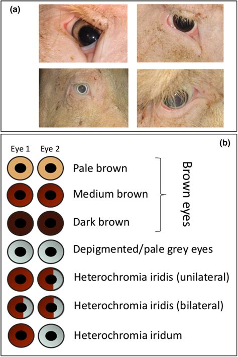 Heterochromia Iridum