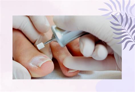 Skin Care, Aesthetic Services Calgary | Skin Treatments Calgary