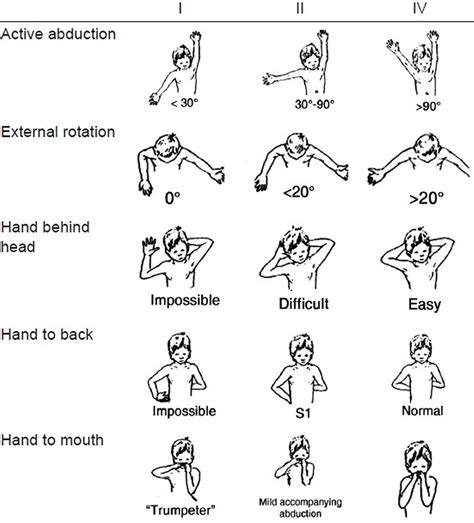 Erb's palsy causes, symptoms, diagnosis, prognosis & Erb's palsy treatment