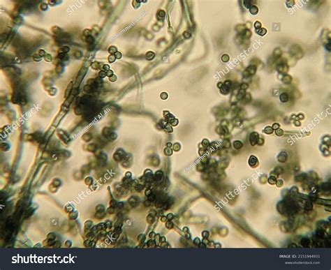 Photo Fungi Hyphae Spores Under Microscope Stock Photo 2151944931 ...