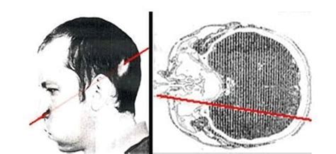 Image result for Person Operating Particle Accelerator