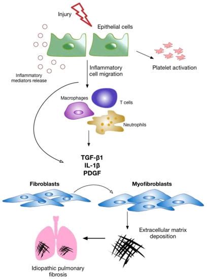Idiopathic Pulmonary Fibrosis: Pathogenesis and the Emerging Role of ...