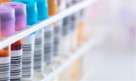 C-peptide has bidirectional association with CV risk in nondiabetic and ...