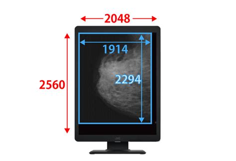 医用モニターの選び方と価格 | 役立つコンテンツ一覧 | 医用モニター / 産業用モニター | JVC