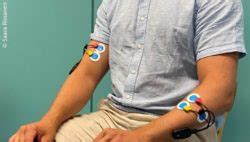 Wearables can help in at-home assessment of myoclonic jerks
