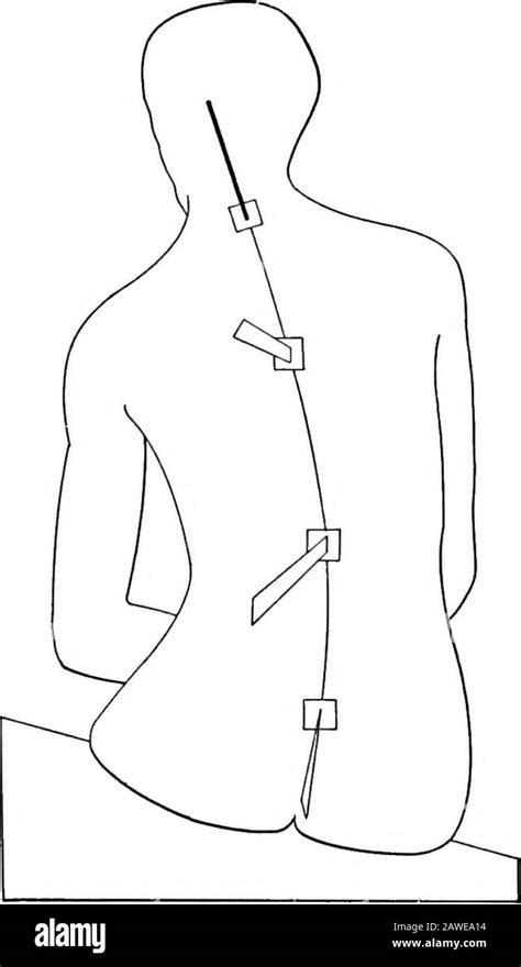 Image result for Contralateral Lateral Flexion