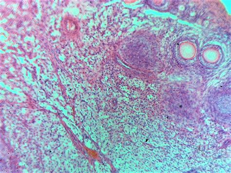 AIM Prepared Slide Histology Testis c.s. & Ovary c.s. (set of 2 ...