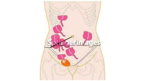 Image result for Understanding the Appendix