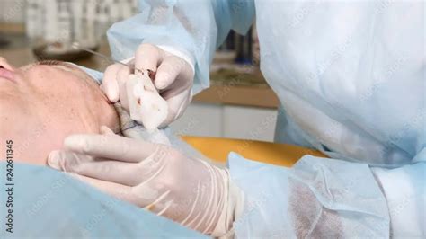 Image result for Cheek Threading