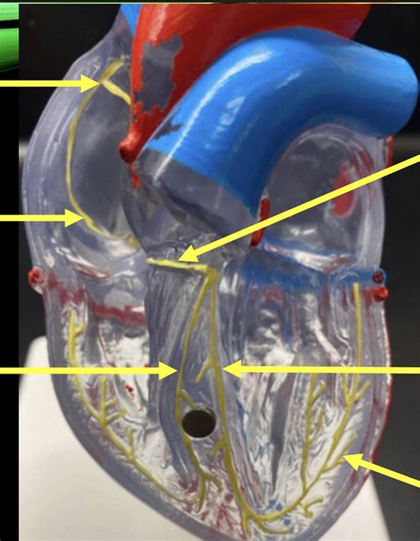 Image result for Cardiac Conduction System Disorders