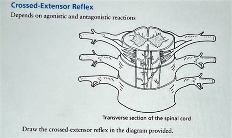 Image result for Crossed Extensor Reflex Demonstration