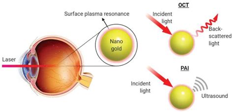 Gold Nanoparticles as Contrast Agents in Ophthalmic Imaging