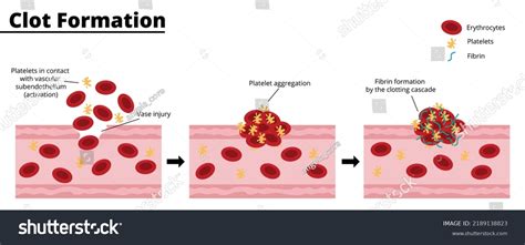 Process of Blood Clotting 的图像结果