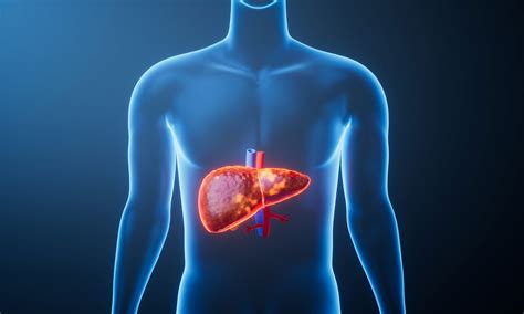 Deadly liver disease is now striking non-drinkers in record numbers ...