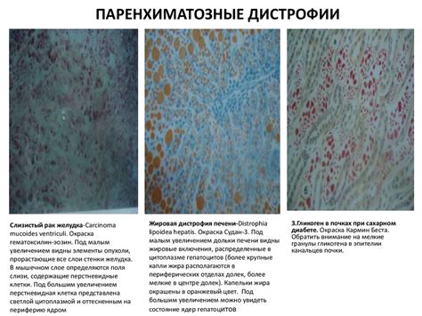 Сборник патанатомических микропрепаратов - презентация онлайн