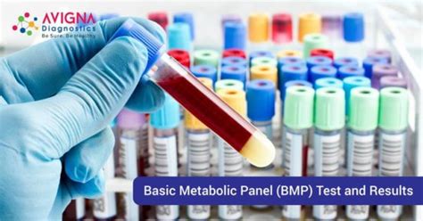 Image result for BMP Basic Metabolic Panel Normal Range