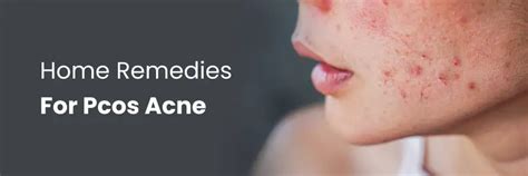 Cómo curar el síndrome de ovario poliquístico de forma natural ...