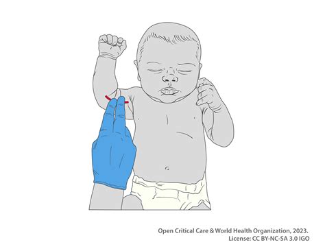 Image Library - Open Critical Care