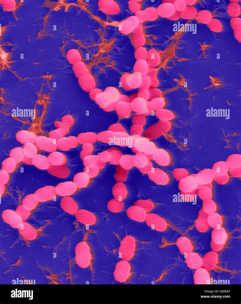 Streptococcus Salivarius Gram Stain