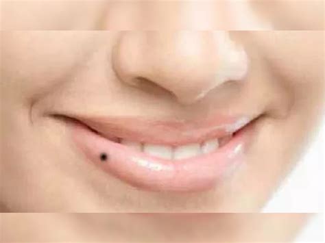 People moles on these 5 parts they live a luxury life apmp | Moles On ...