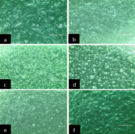 Fig. 16: AO/EB staining and PI staining to study apoptosis